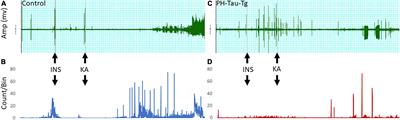 Pathological Human Tau Induces Alterations in the Brain Insulin Signaling Cascade